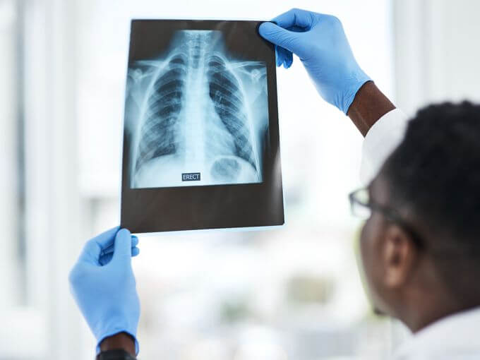 Digital X-ray imaging at B Excel Radiology